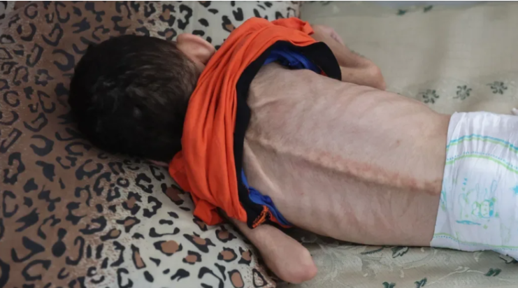 يونيسف: استشهاد 28 طفلا في غزة يوميا جوعا وقصفا